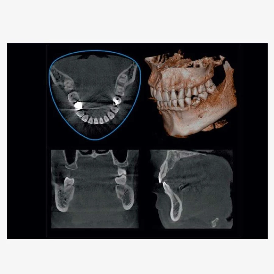 Máy X-quang nha khoa 3D Veraviewepocs R100