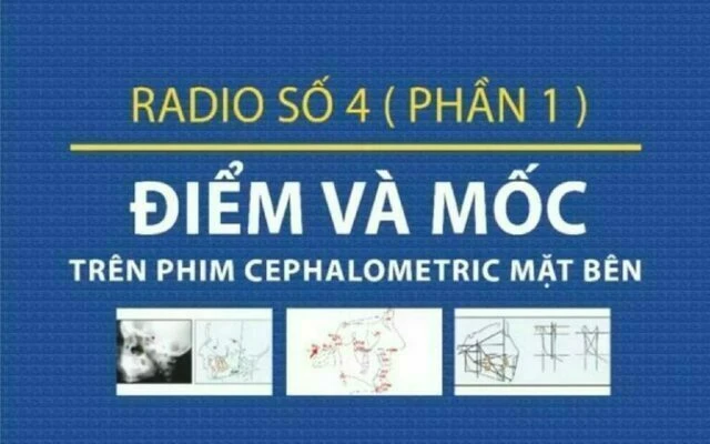 phim cephalometric mặt bên