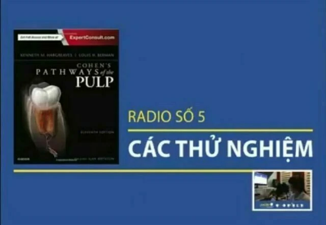 thử nghiệm tủy răng