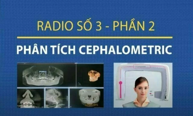phân tích phim cephalometric