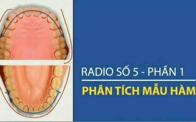 phân tích mẫu hàm