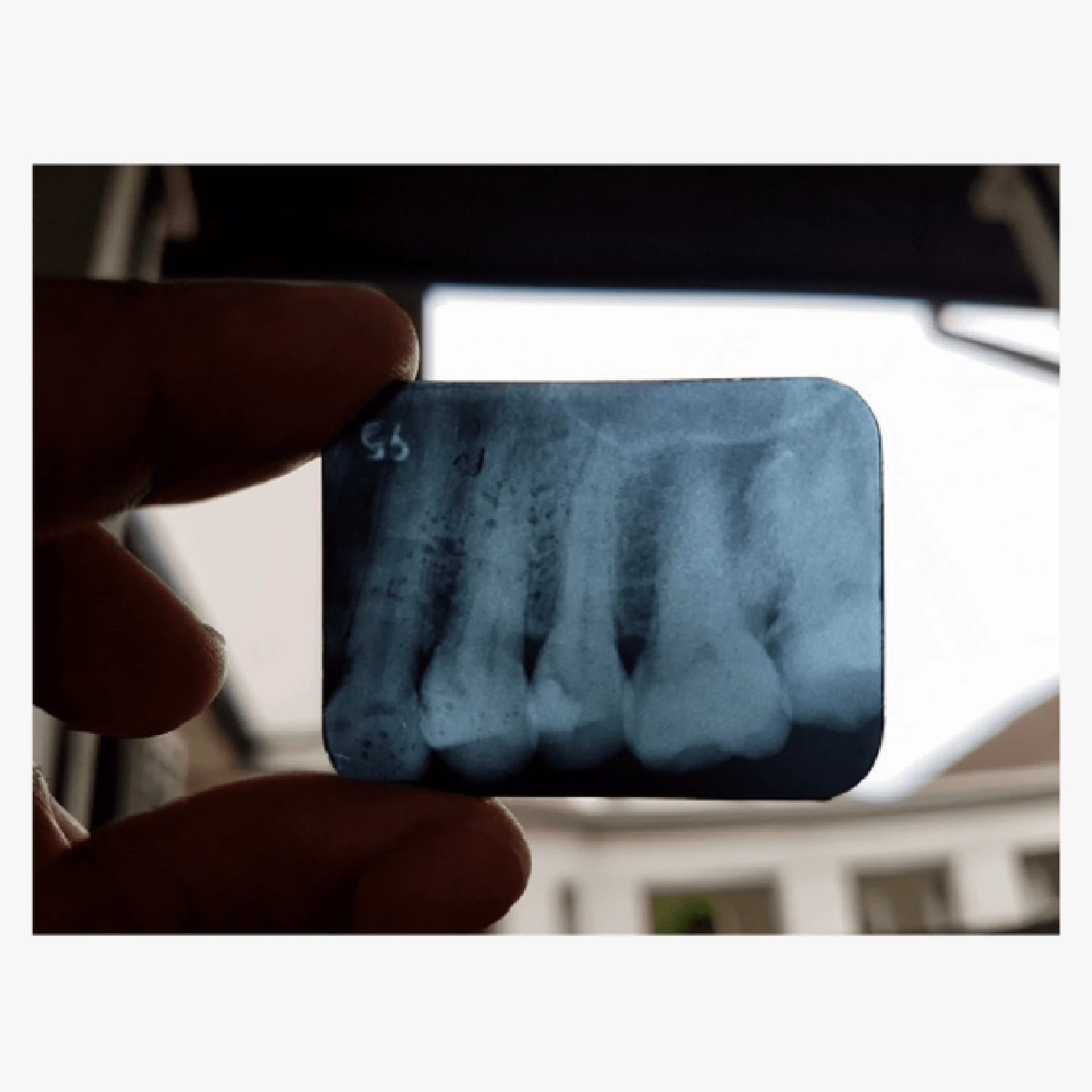 Phim rửa nhanh nha khoa dental film