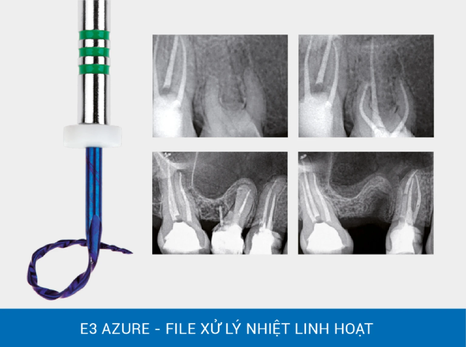 Quản lý cấp cứu nội nha toàn diện
