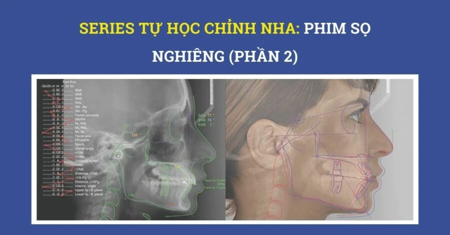 Series tự học chỉnh nha: phim sọ nghiêng (phần 1)