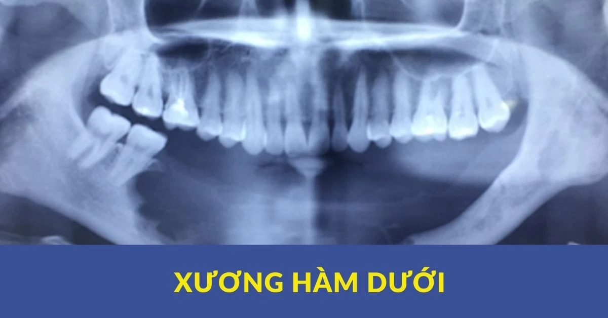 Xương hàm dưới – giải phẫu (phần 1)