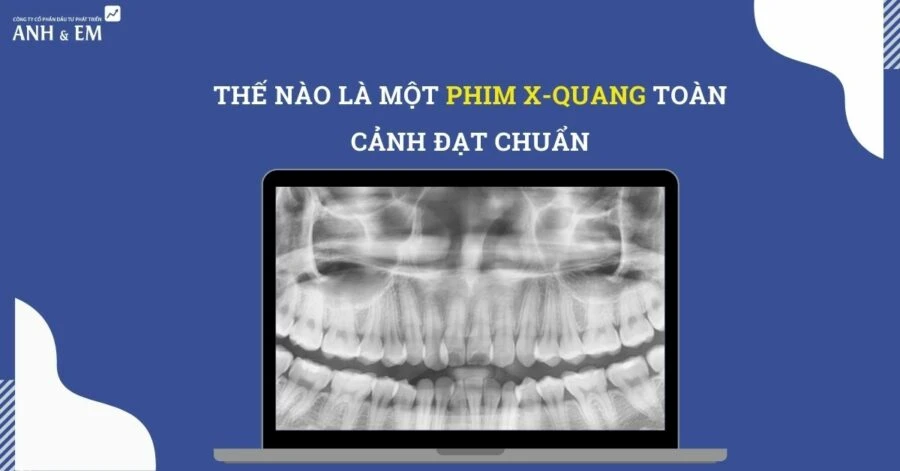 Thế nào là một phim x quang toàn cảnh đạt chuẩn