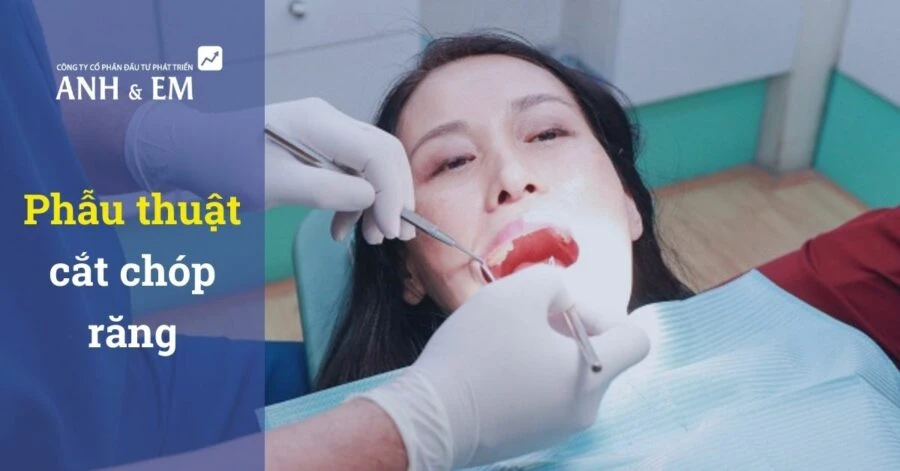 Phẫu thuật cắt chóp răng – kỹ thuật cơ bản