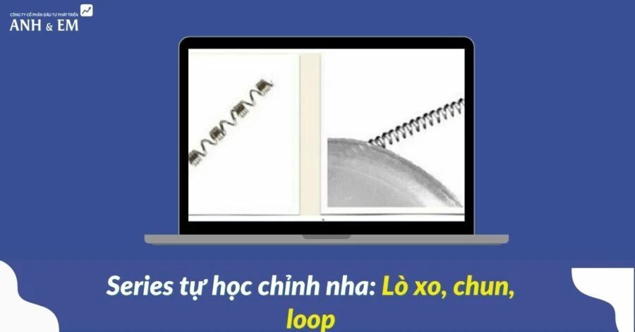 Series tự học chỉnh nha: lò xo, chun, loop