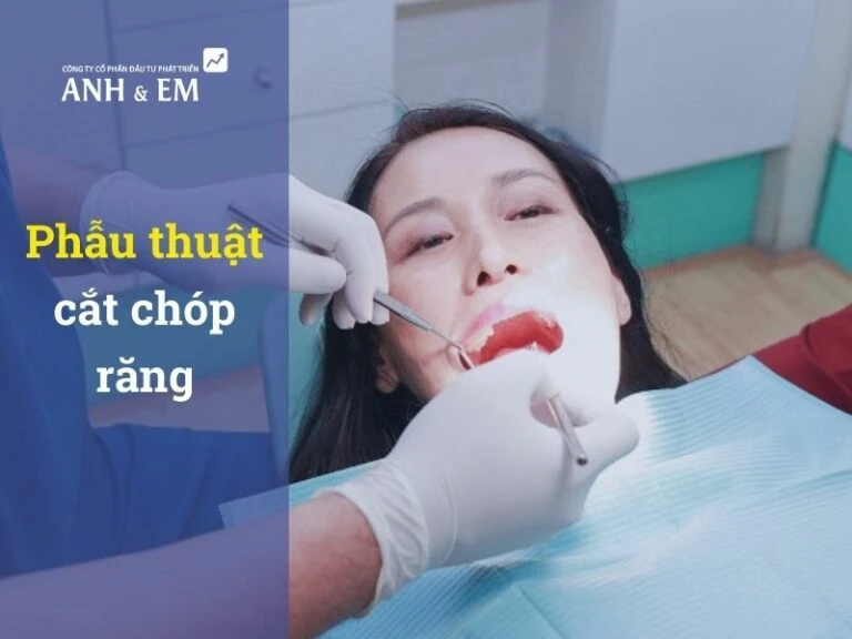 phẫu thutậ cắt chóp răng