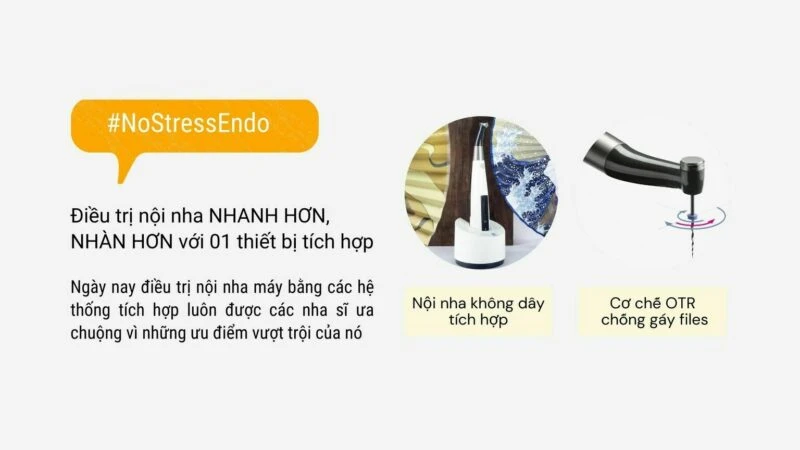 Năm tiêu chí lựa chọn máy nội nha tốt nhất