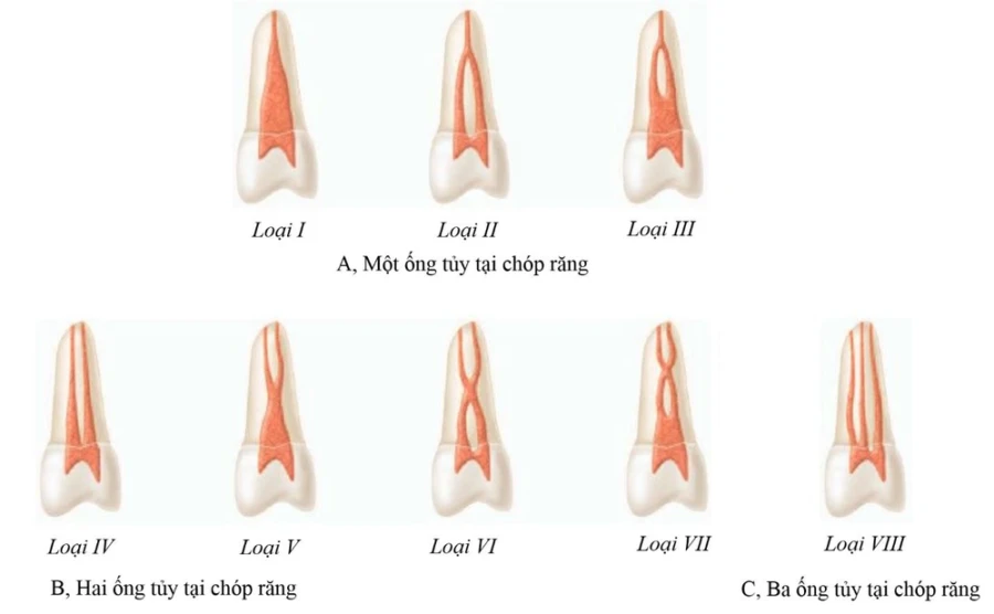 Giải phẫu ống tủy