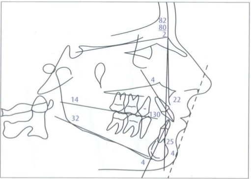 xương hàm trên và xương hàm dưới, Công ty Anh &amp; Em | J. Morita Việt Nam