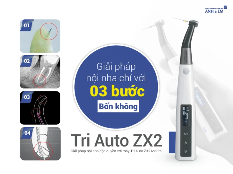 noi-nha-3-buoc-4-khong