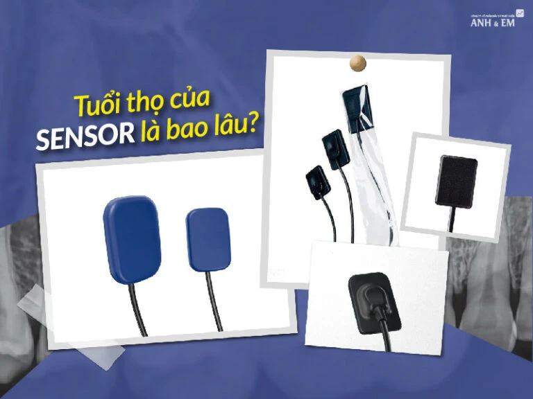 tuoi-tho-cua-sensor-la-bao-lau