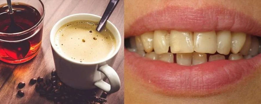 Lời khuyên nha sĩ về bảo vệ răng miệng chắc khỏe cà phê