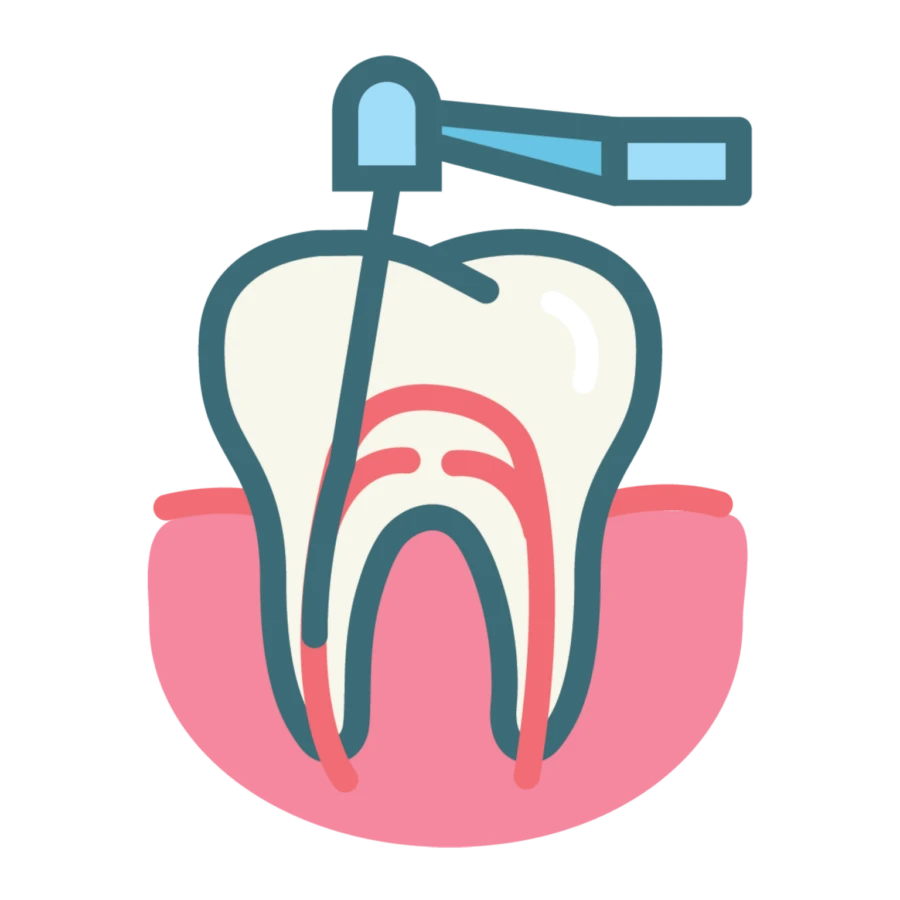 Sai lầm phổ biến nhất trong điều trị nội nha và cách khắc phục