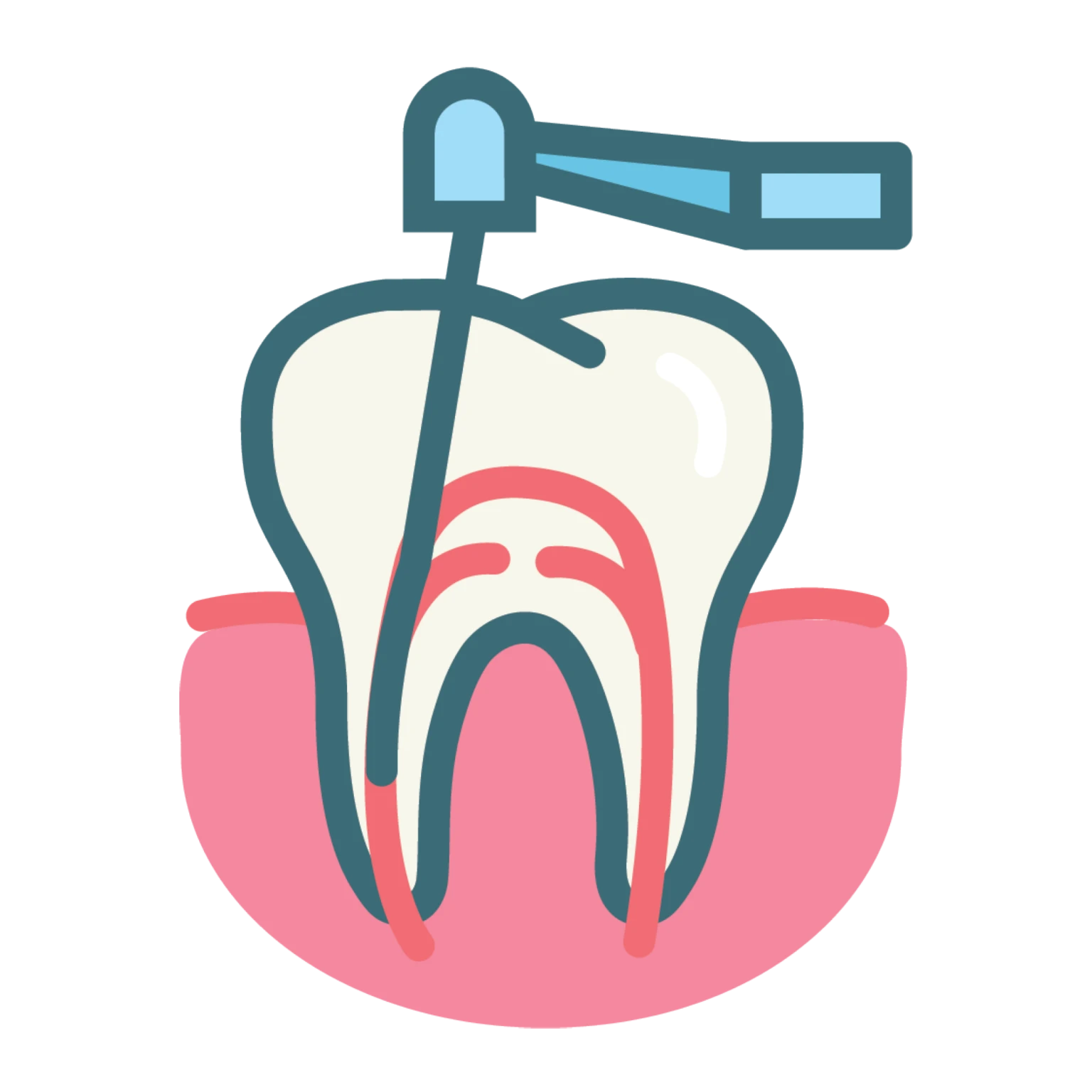 Sai lầm phổ biến nhất trong điều trị nội nha và cách khắc phục