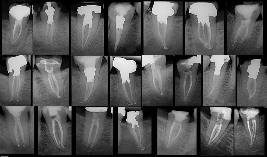 Hình thái học răng