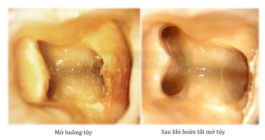 Thách thức khi thử nghiệm tủy