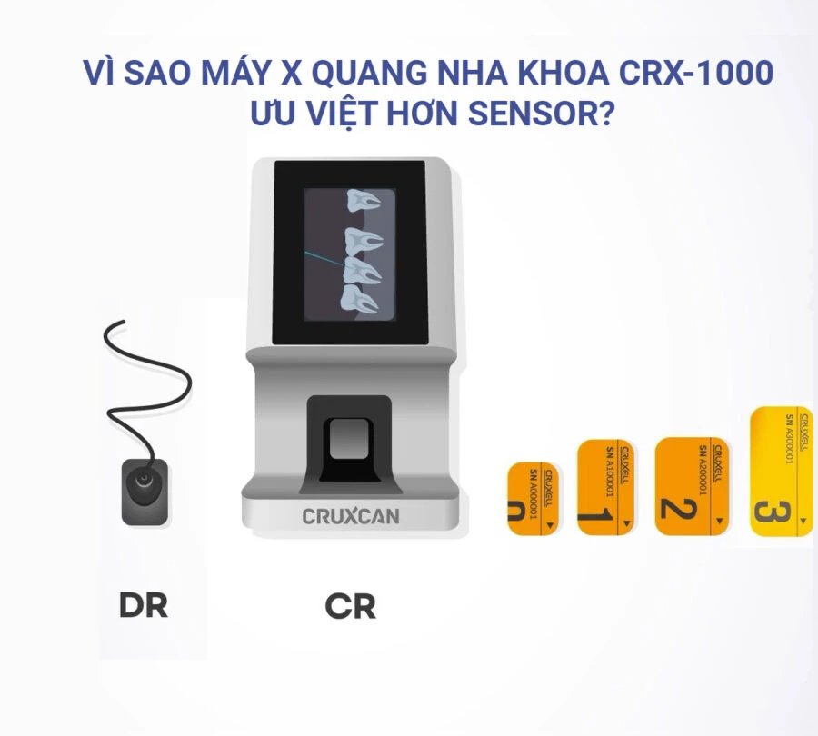 Vì sao máy quét phim CRX-1000 được đánh giá ưu việt hơn sensor?