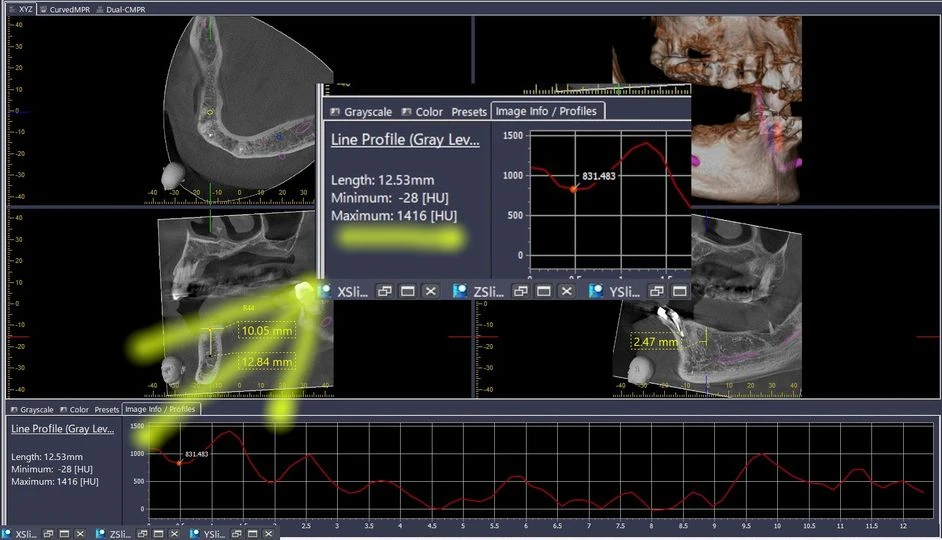 Có những yếu tố mà không hãng CBCT nào nói cho bạn biết