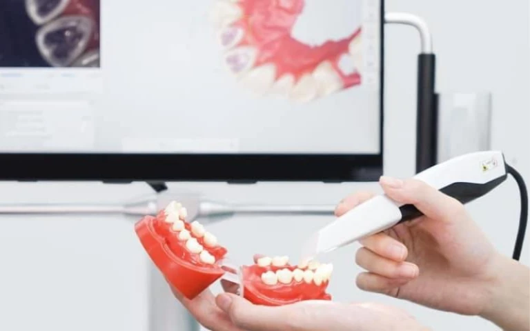 Hình ảnh từ máy quét trong miệng