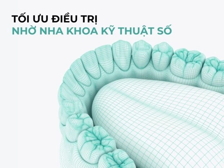 Tối ưu điều trị nhờ nha khoa kỹ thuật số