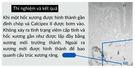canxi hydroxide trộn sẵn, Công ty Anh &amp; Em | J. Morita Việt Nam