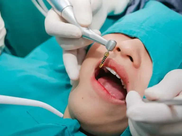 cấy ghép implant