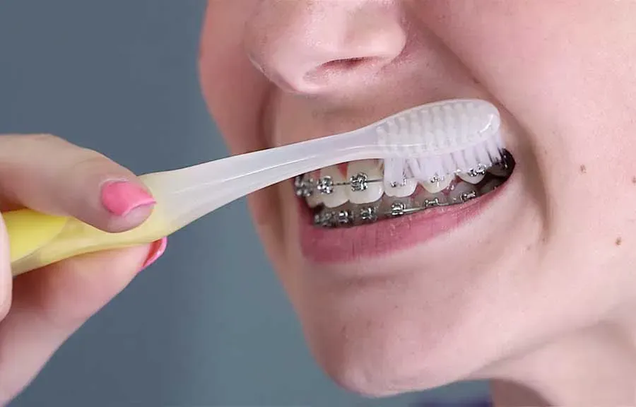 vệ sinh răng miệng
