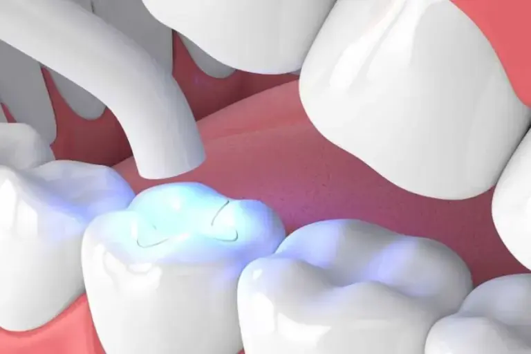 mòn cổ chân răng