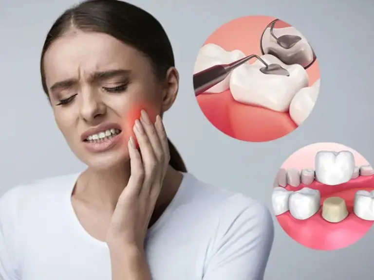 bọc răng sứ khi sâu răng