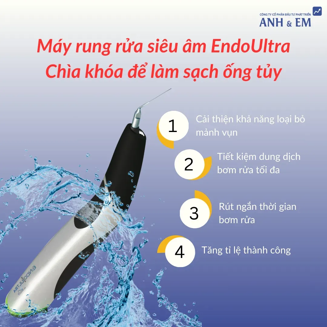 Ưu – nhược điểm của phương pháp làm sạch ống tủy bằng trâm/file tay