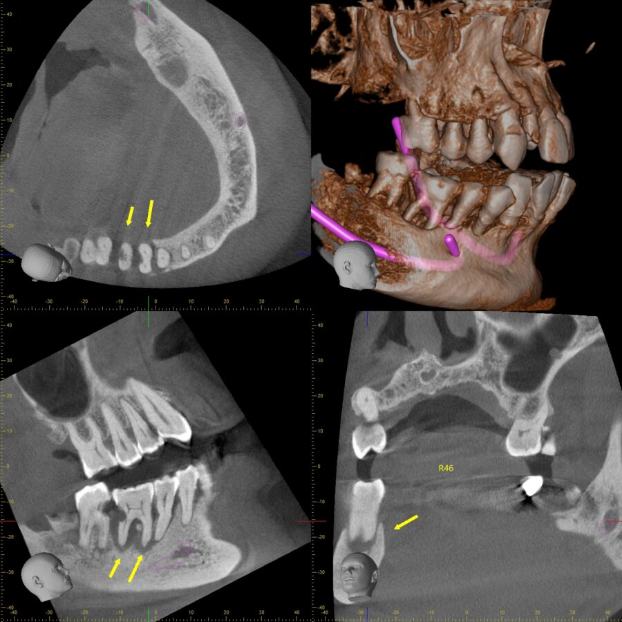 hình ảnh CBCT