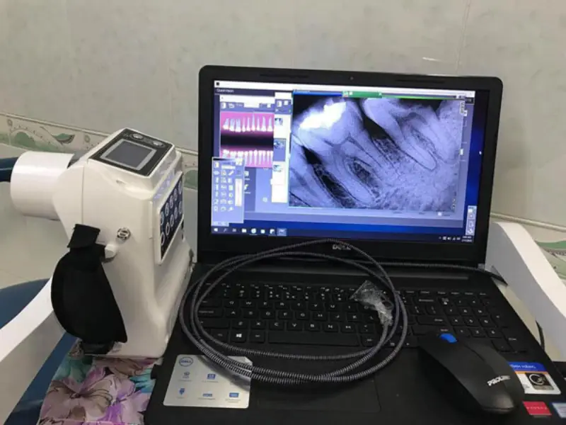 Thiết bị quét Sensor 
