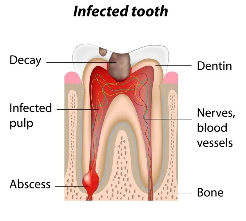 ong-tuy-tiet-dich-dai-dang, Công ty Anh &amp; Em | J. Morita Việt Nam