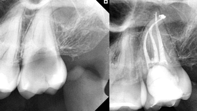 tạo đường trượt