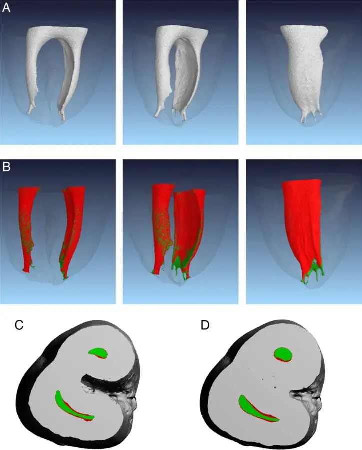 sửa soạn ống tủy, C&ocirc;ng ty Anh &amp; Em | J. Morita Việt Nam