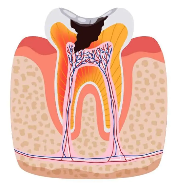 vi-ke-trong-phuc-hinh-co-dinh, Công ty Anh & Em | J. Morita Việt Nam
