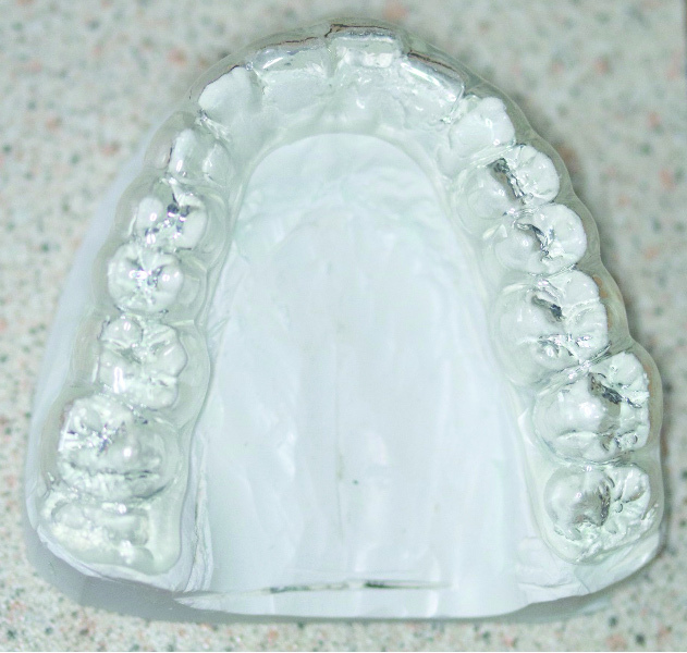 Hình 3: Máng tạo hình chân không