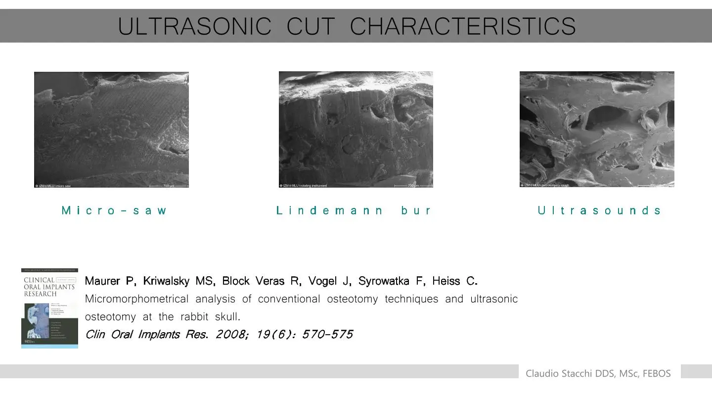 nguyên lý cắt chọn lọc