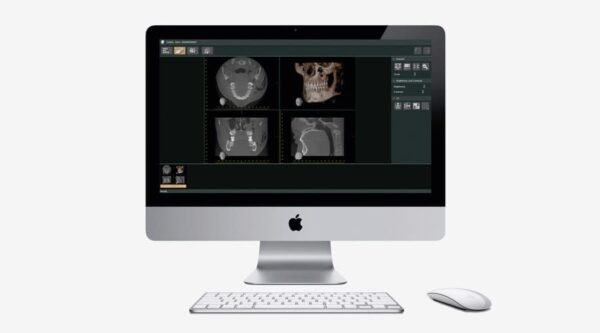I-dixel WEB