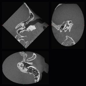 Máy chụp cắt lớp cone beam CT 3D Accuitomo 170
