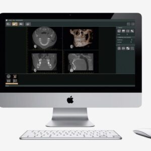 Phần mềm hình ảnh nha khoa i-dixel WEB