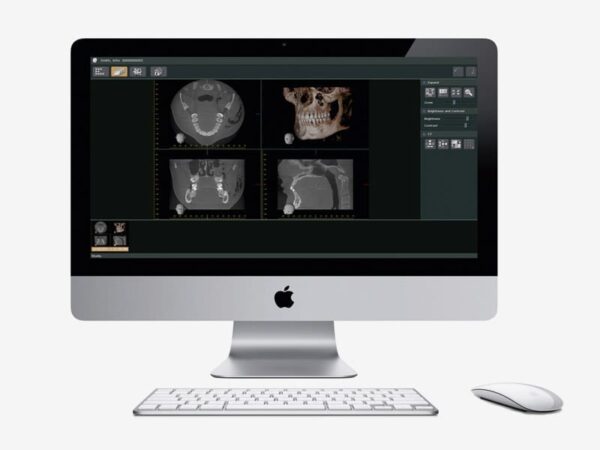 Phần mềm hình ảnh nha khoa i-dixel WEB