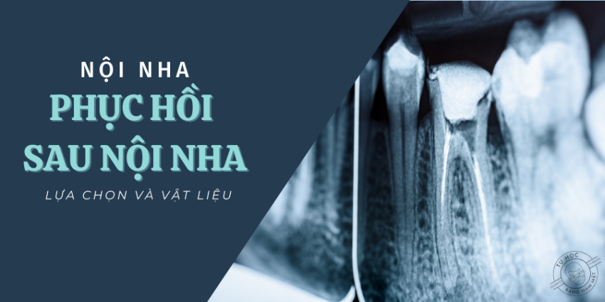 Điều trị nội nha lại — Khi bằng chứng ủng hộ việc giữ lại