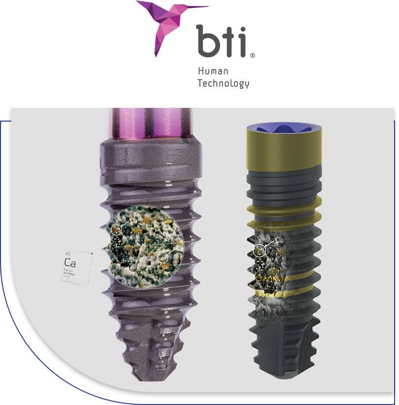 Hệ thống implant BTI với công nghệ bề mặt UnicCa tích hợp ion Canxi Ca2+