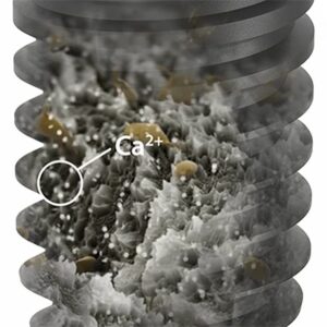 Bề mặt UnicCa®: Bước nhảy vọt về công nghệ sinh học trong hệ thống BTI Implant