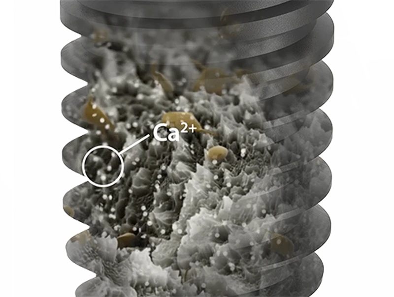 Bề mặt UnicCa®: Bước nhảy vọt về công nghệ sinh học trong hệ thống BTI Implant