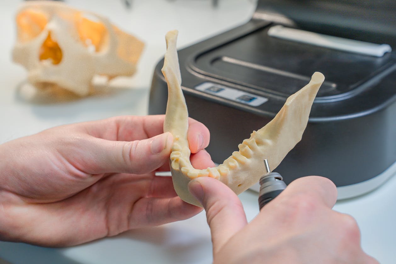 Digital workflow nha khoa — mô hình 3D và lập kế hoạch implant